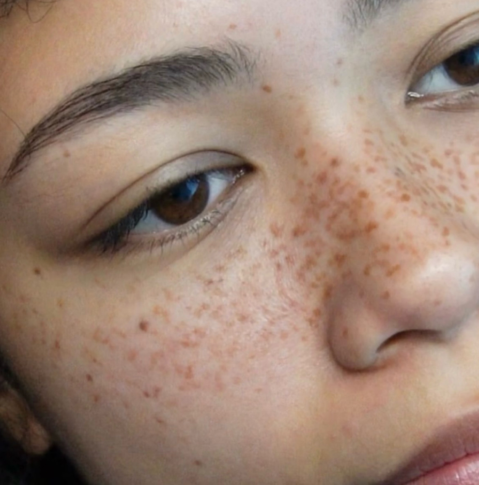 Faux Freckels Tattoo at Simply Snatched in Nevada, MO