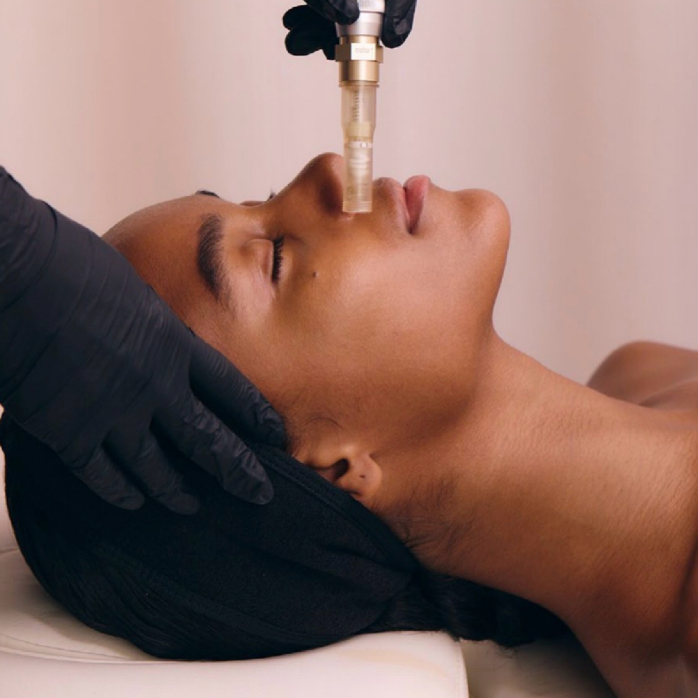 Nano-Needling Add On Face Only at SKINJEVITY BY DARA in Castle Rock, CO