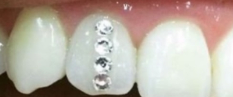 Cosmetic Jewelry Single Track