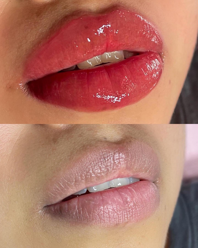 Neutralización de labios Oscuros