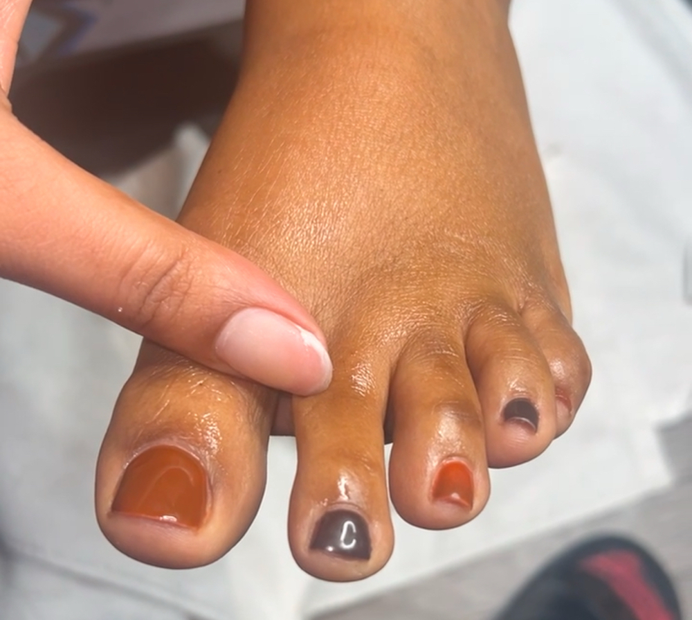 Toes