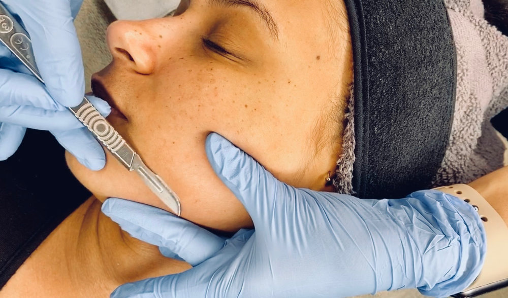 The Dermaplaning Facial