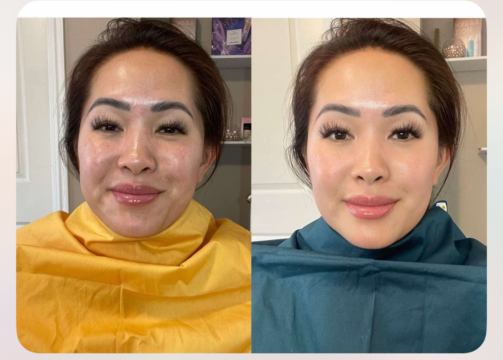 Platinum Season analysis - grand