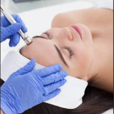 Microdermabrasion at Shear Beaute in Cheyenne, WY