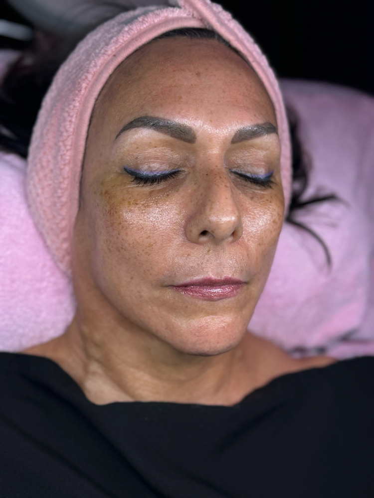 Nano+Dermaplaning Facial Treatment