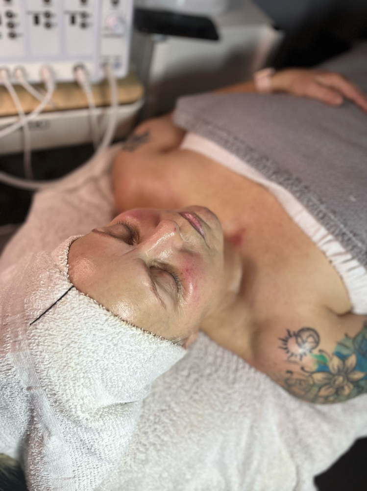 Microdermabrasion Facial