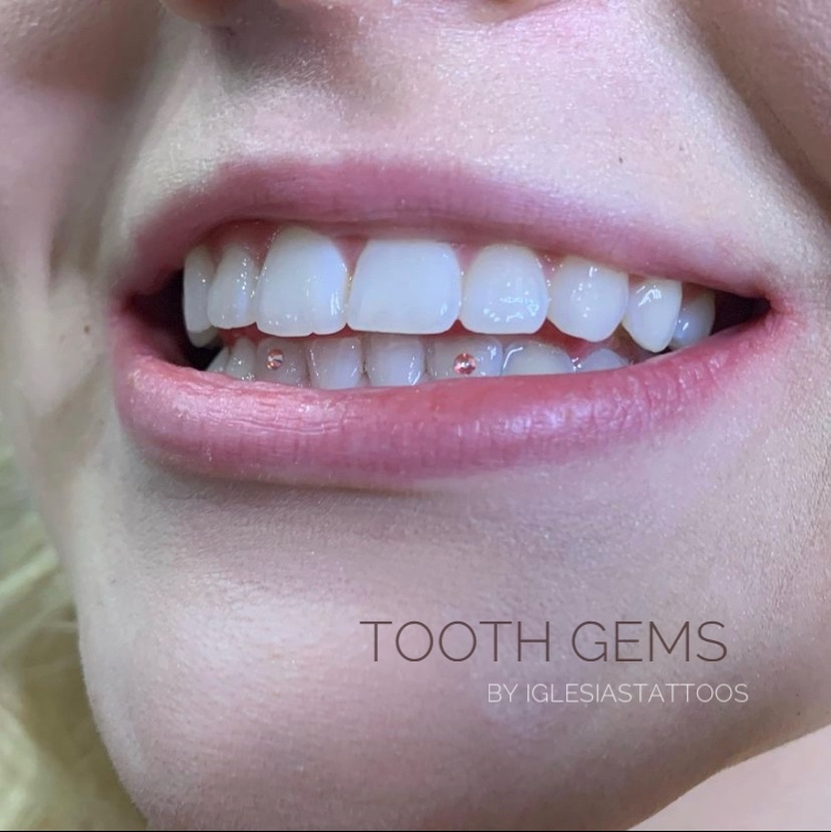 Tooth Gems
