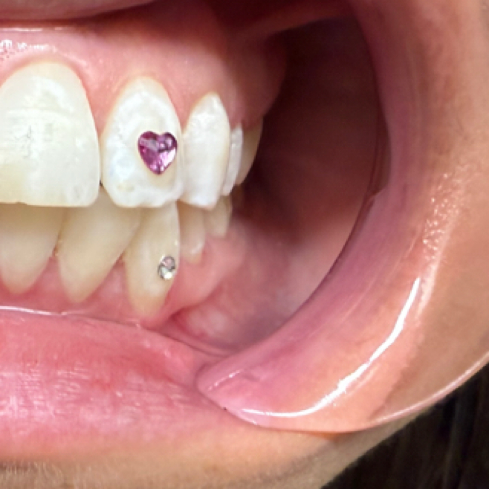 Tooth Gem Application Shapes ♥️⭐️♦️ at Icey Whites By Blondee in Lawrence, MA