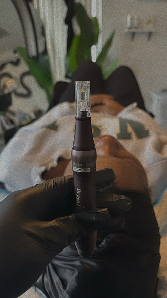 MICRONEEDLING PACKAGE -CONSULT REQ