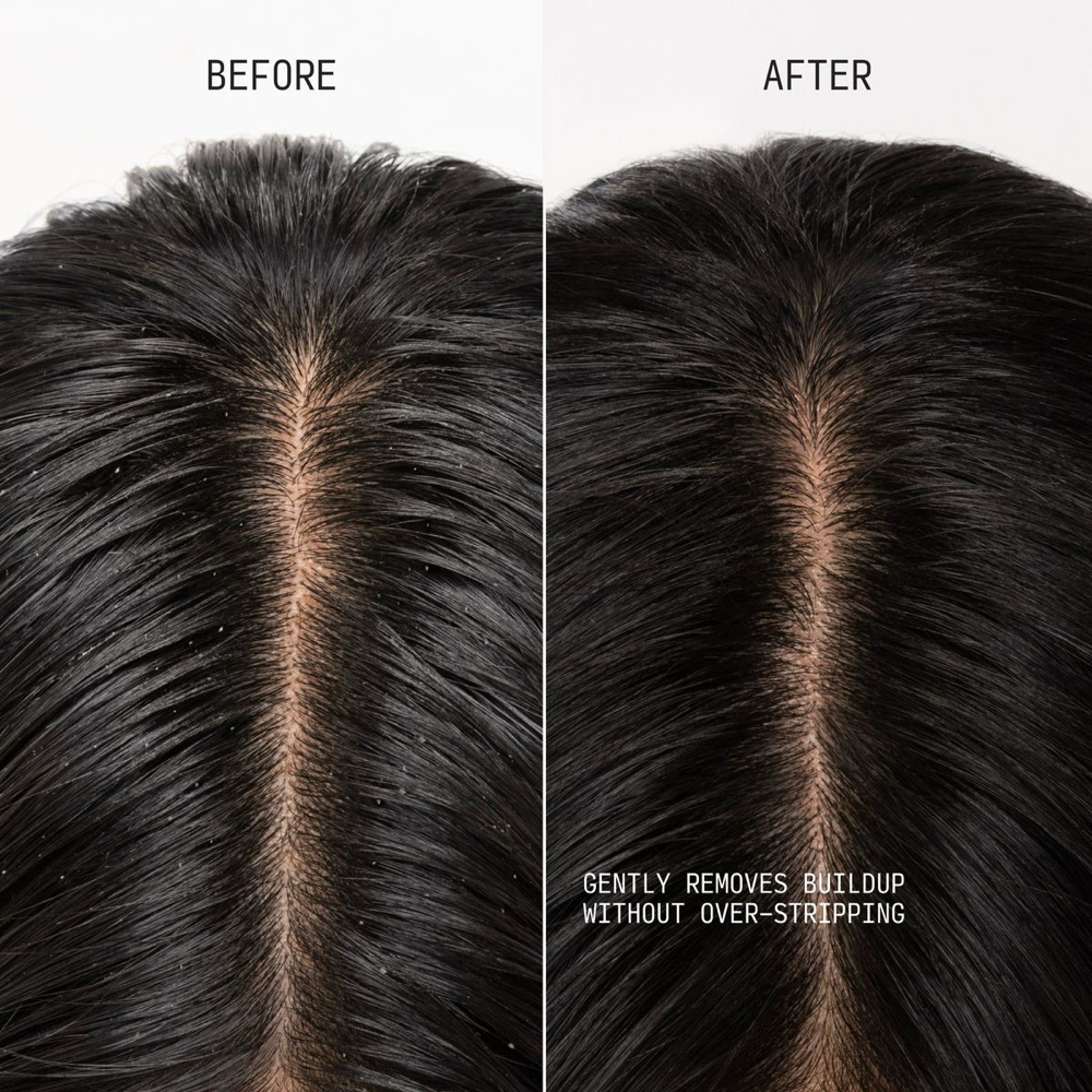 Scalp Exfoliation Treatment at GlowNGo in Port Orange, FL