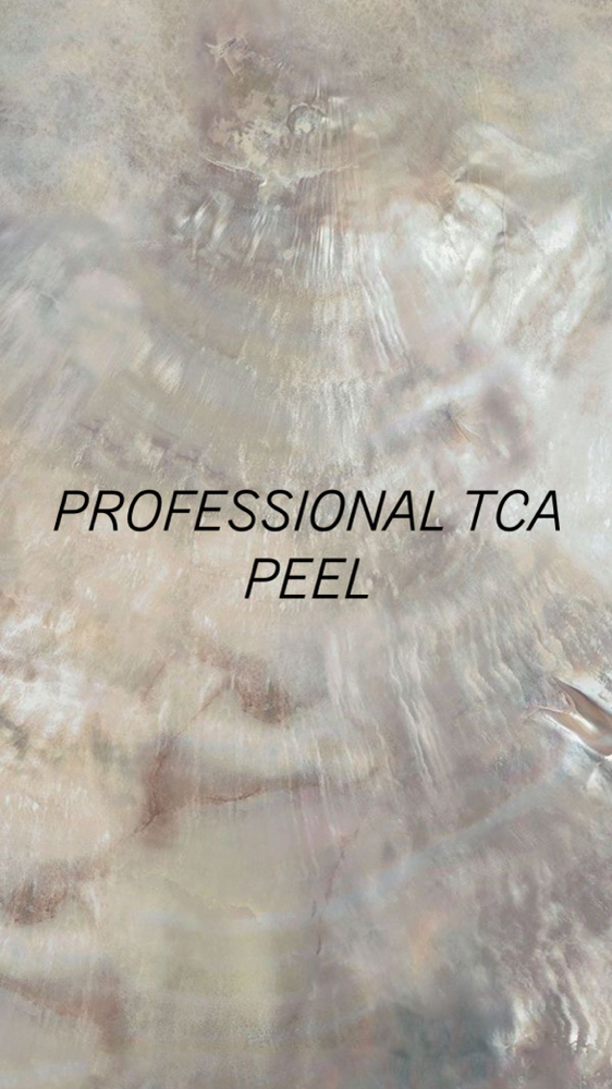 Professional TCA Peel 15% Solution