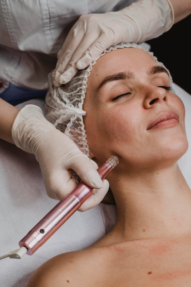 RF Microneedling + Peptide Serum