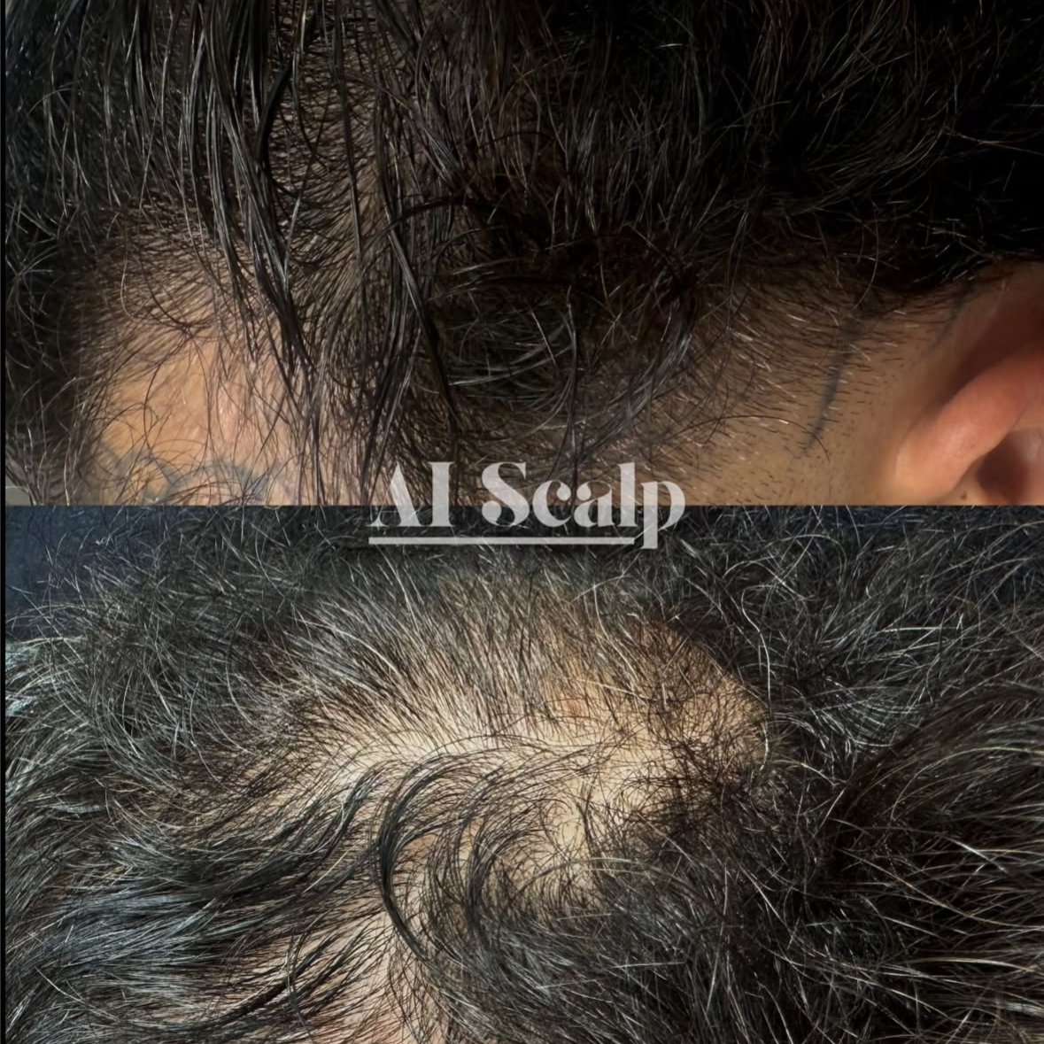 Ai Scalp Refinement Session at Alchemy Haus by Devyn | Color. Extensions. Scalp Density. in Atlanta, GA