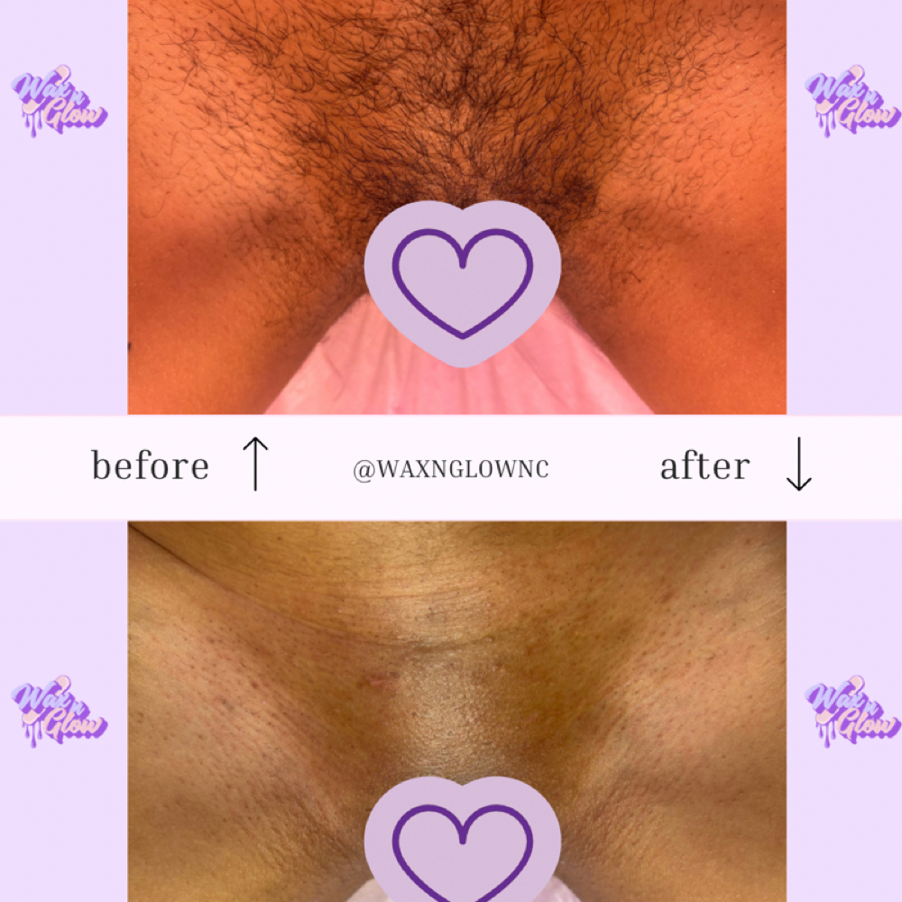 Brazillian at Wax N Glow LLC in Raleigh, NC