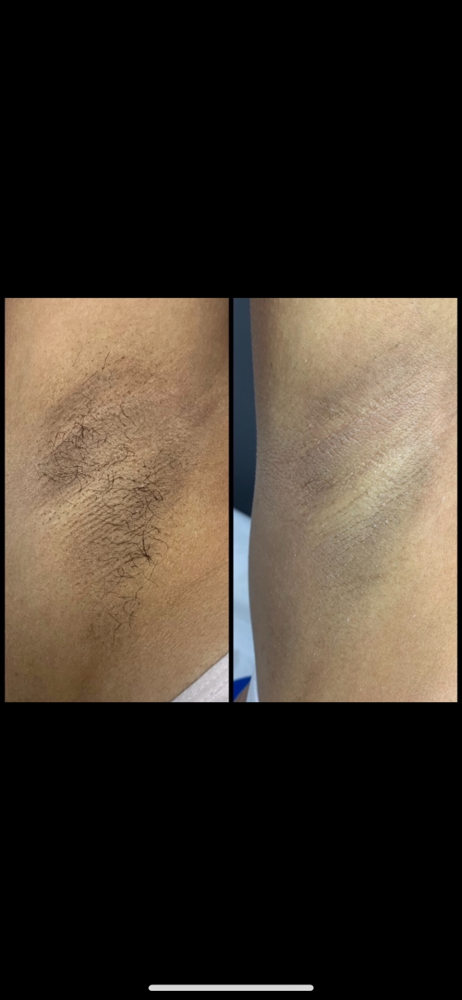 Underarm Wax