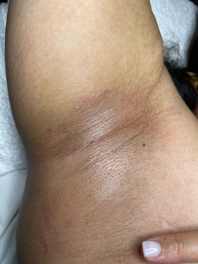 Underarm Wax
