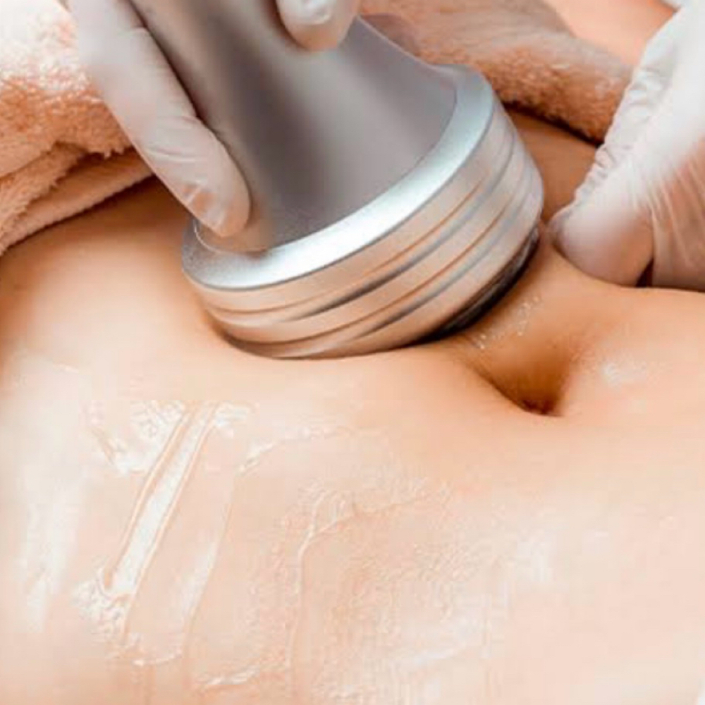 Cavitation at Beyond the Skin in North Chelmsford, MA