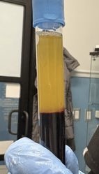 LiqPRF  Regenerative Injection x 1