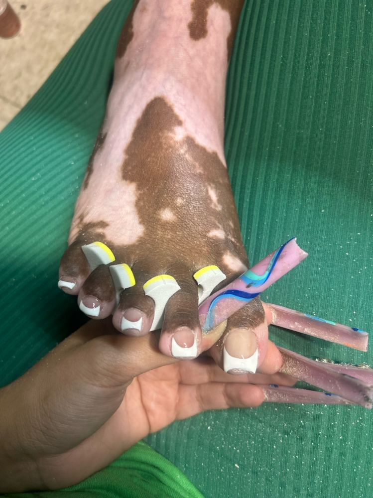 Acylic Big Toes W Polish Change