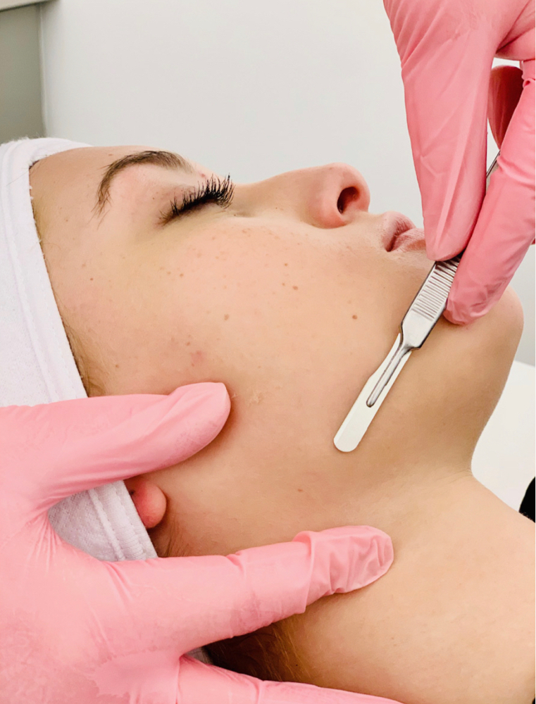 Dermaplane Only