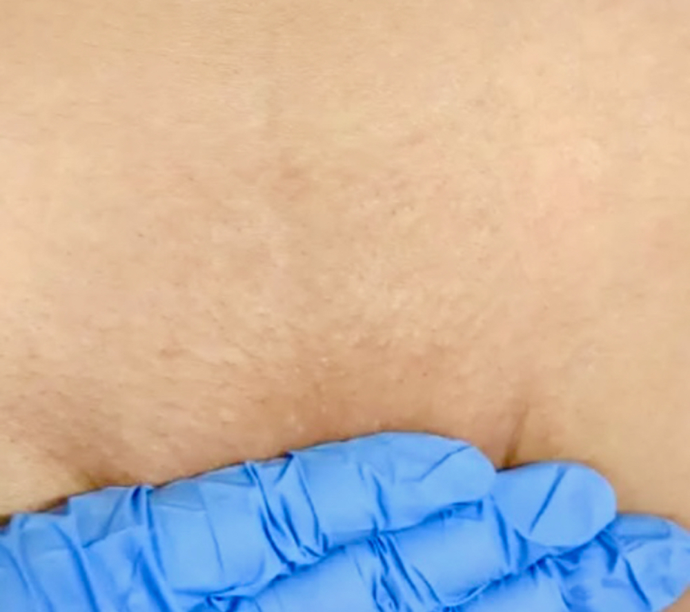 Stephanie Brazilian wax