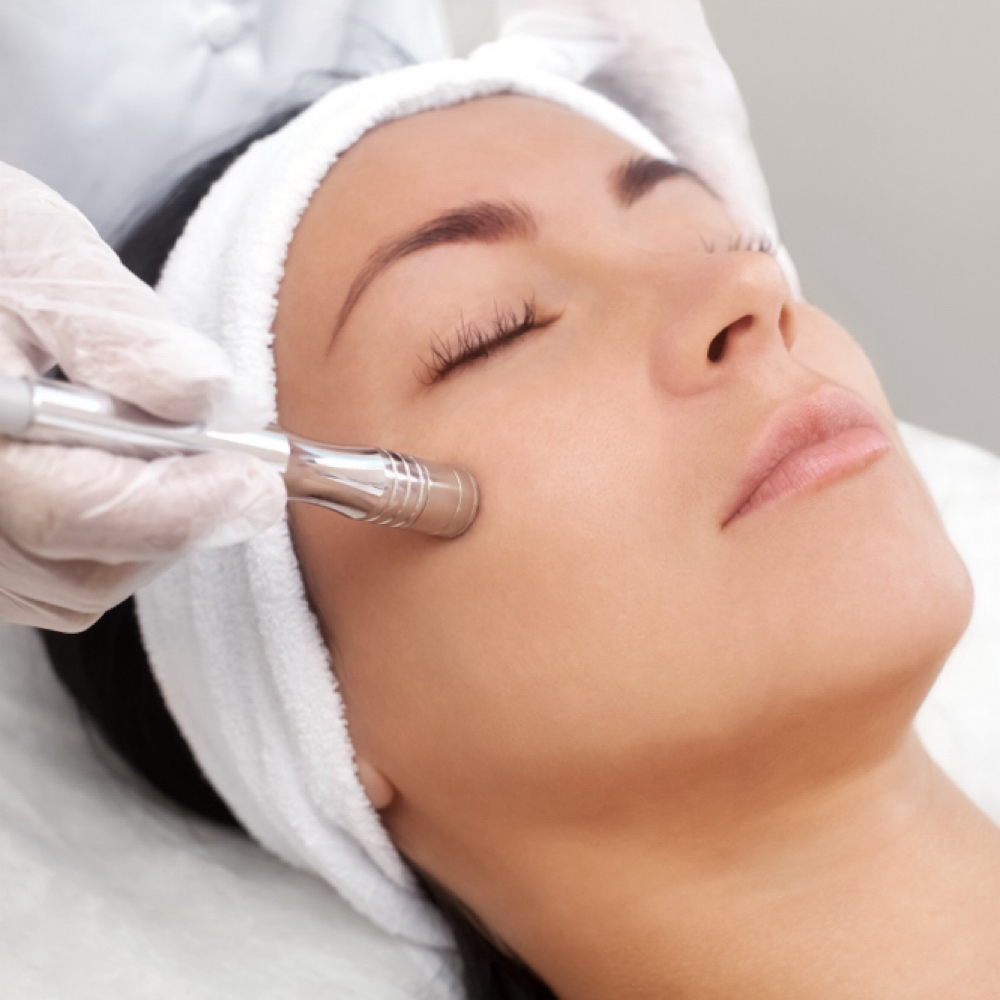 Dermabrasion at Aura Aesthetics in Houston, TX