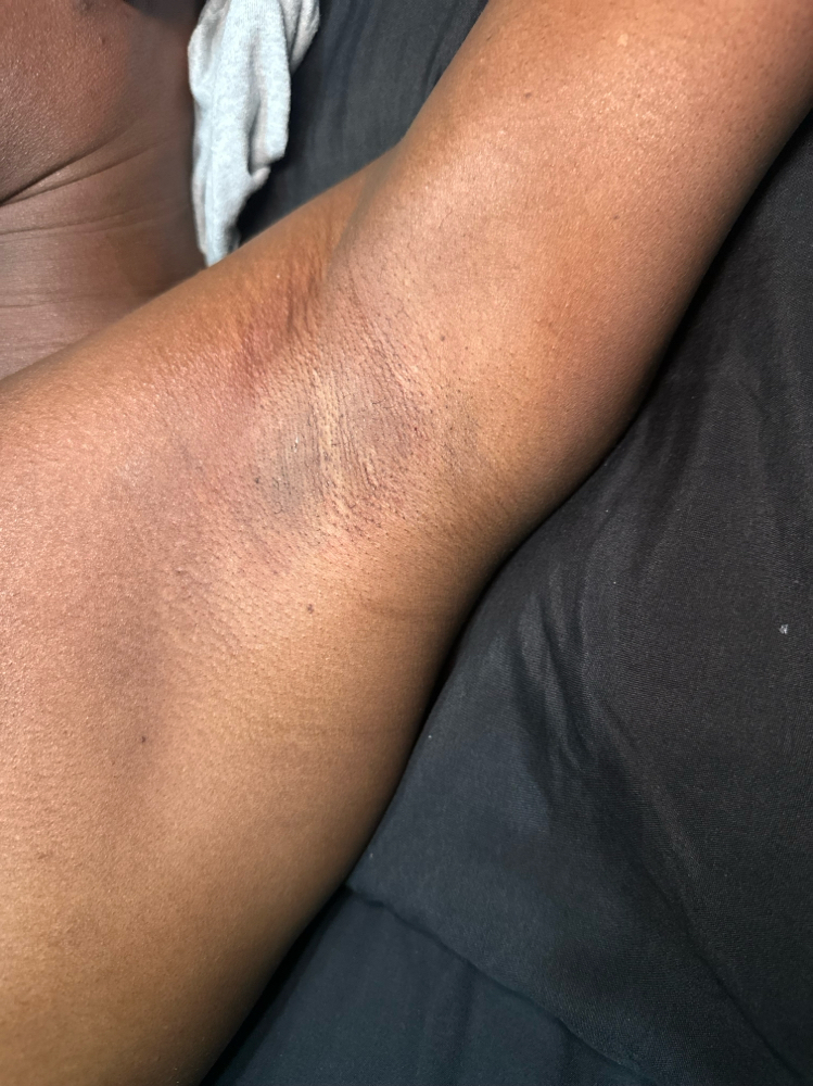 Underarm Waxing at Masterpiece An All Inclusive Experience in Hollywood, SC