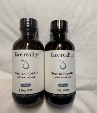 Acne Boot Camp Peel