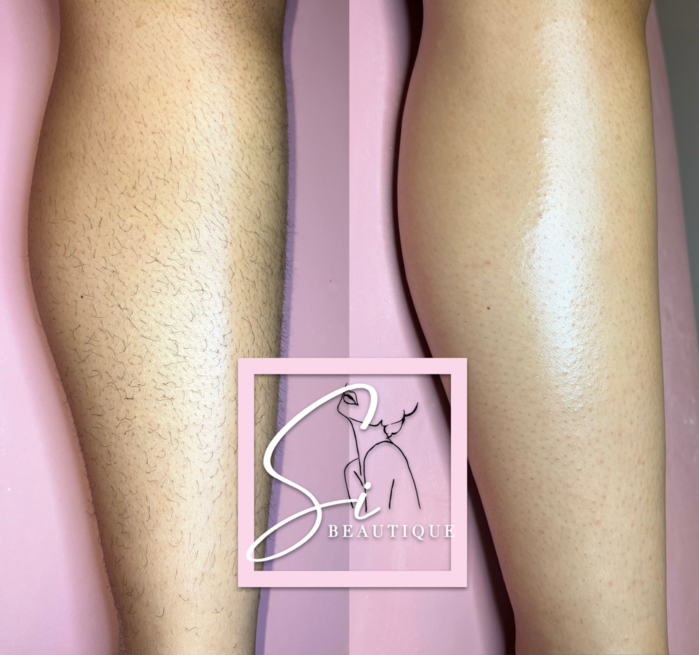 Half Leg - Upper Thigh Or Lower Leg