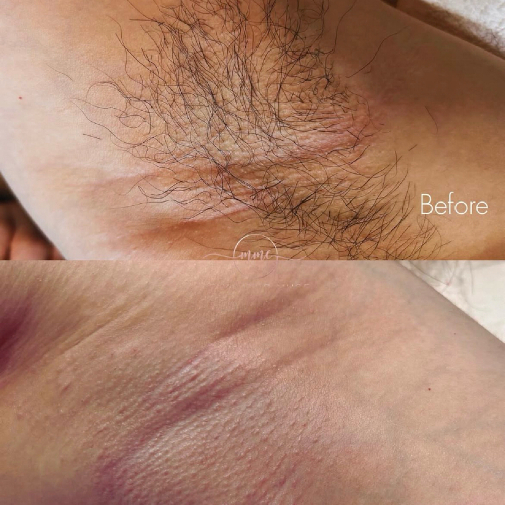 Under Arm Wax at Velvet Glow Atelier™️ in Houston, TX