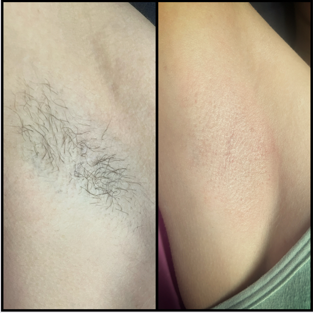 Underarm Wax at Mad Threading in Rockford, IL