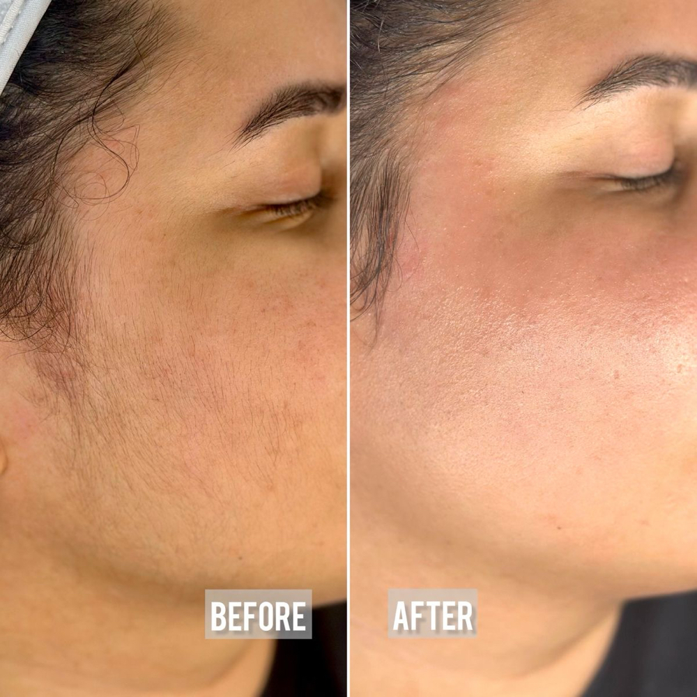 Cheeks at Charismatic Beauty in Apple Valley, CA