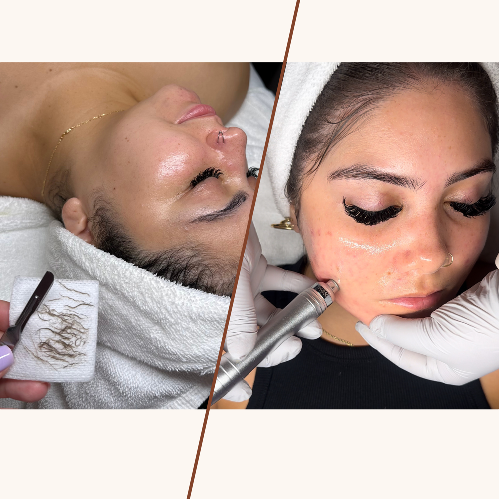 Golden Glow Facial