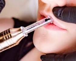 Hyaluron Needless Lip Filler Class