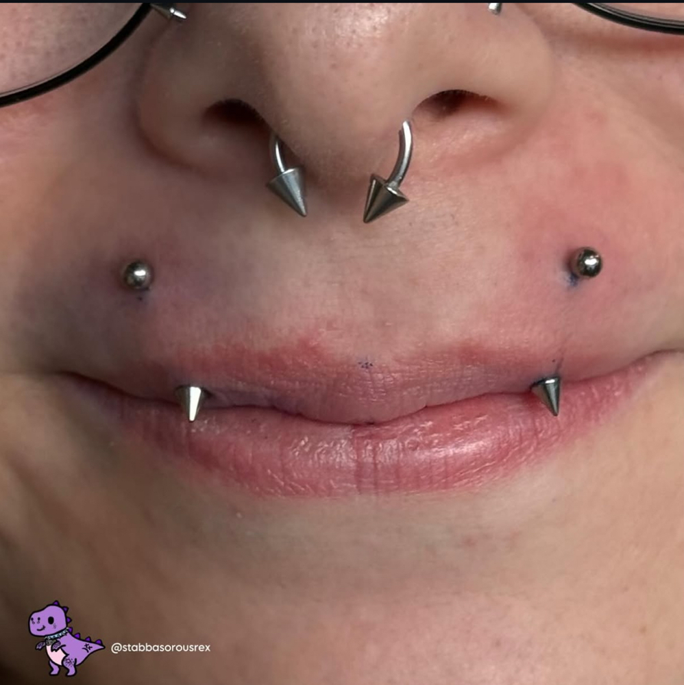 Vampire Bites