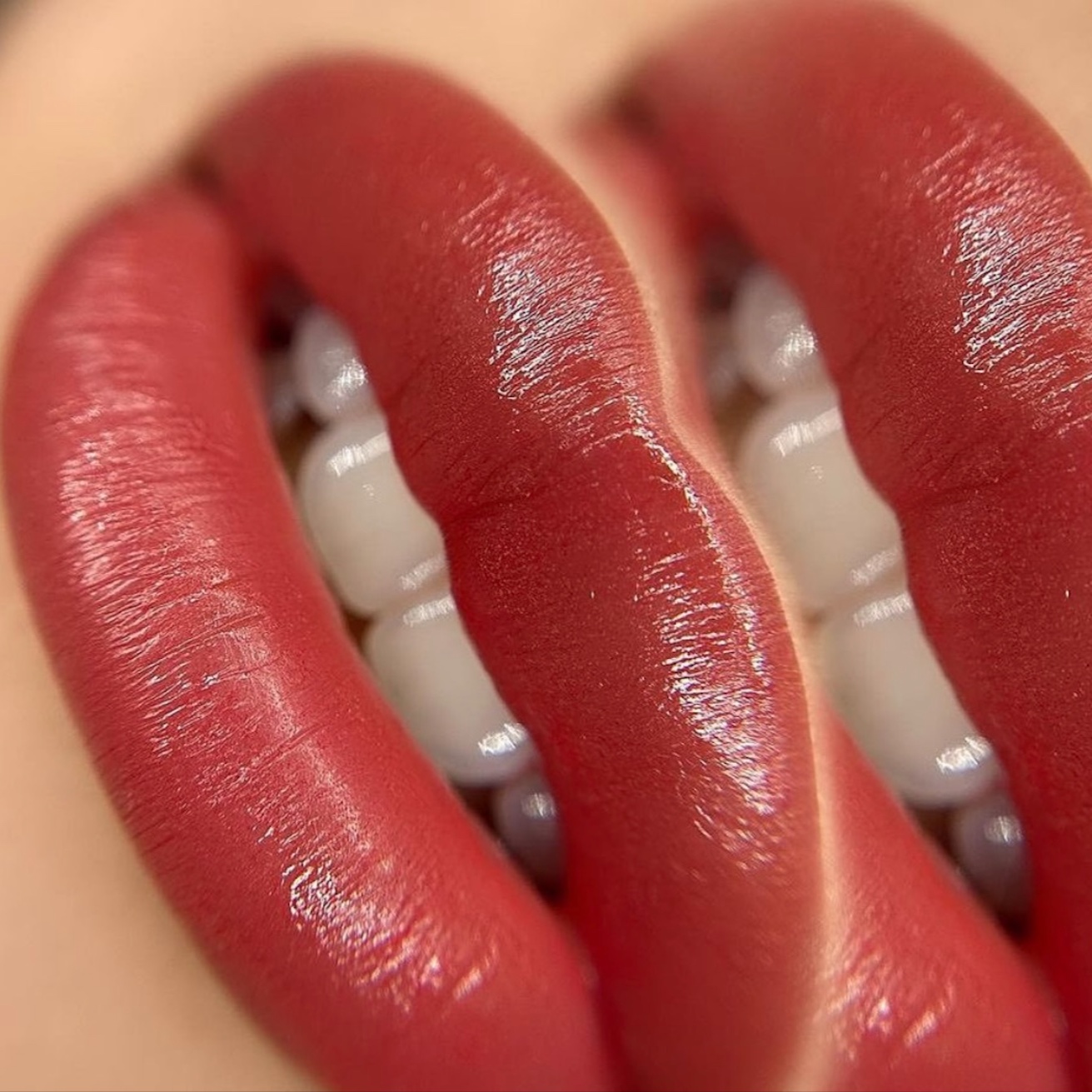 1 YR REFRESHING LIPS