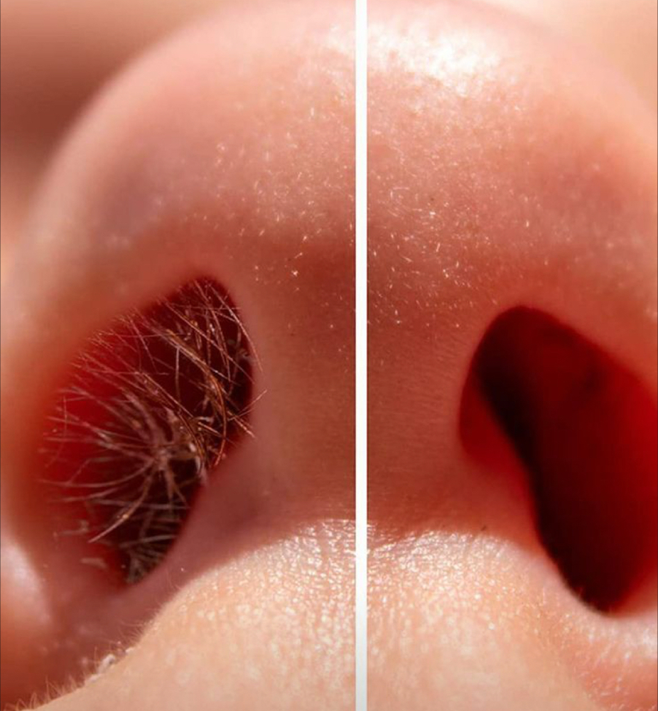 Nose Wax