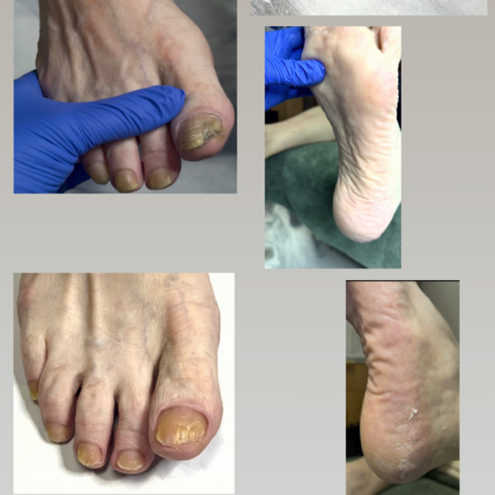 Wellness pedicure Tier 2 at CHIC NAILS in San Antonio To, TX