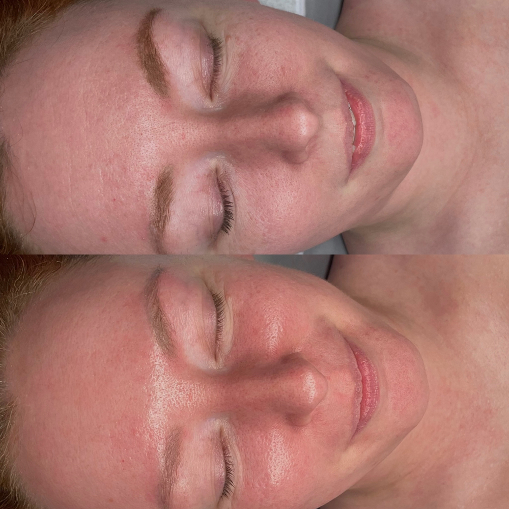 Sunrise Custom Facial