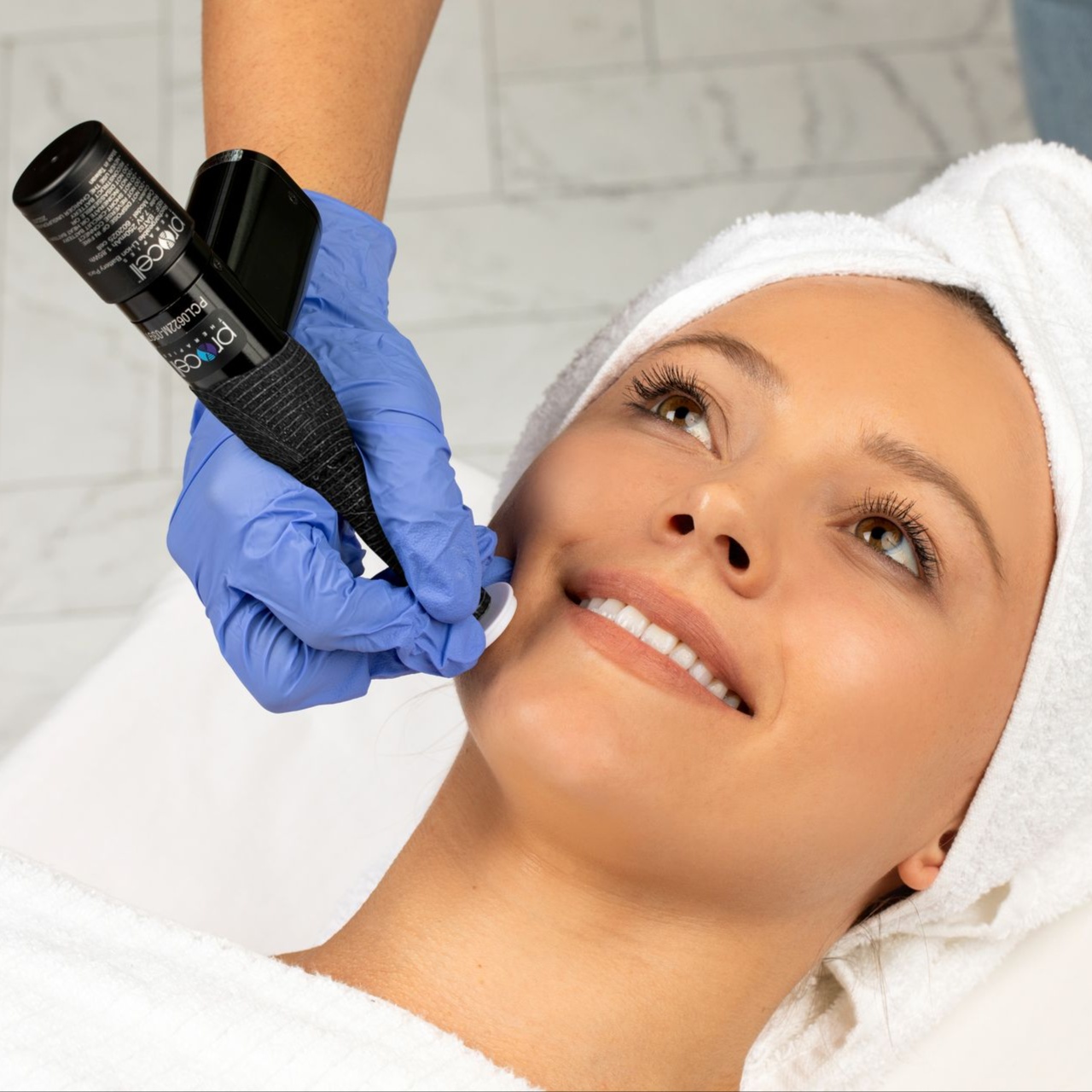 Micro Channeling Treatment at Restore Face and Body Studio in Osage Beach, MO