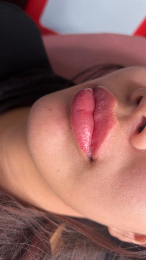 Russian Lips 1ml