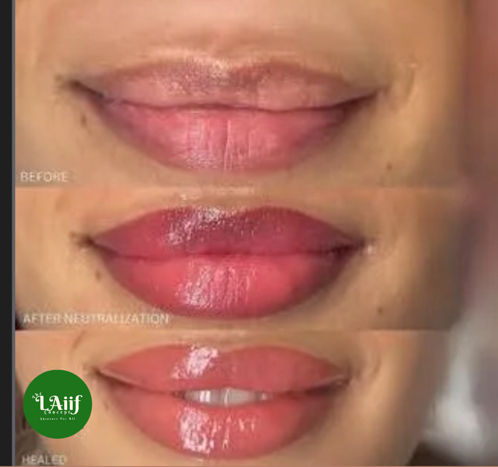 Lip Micropientation/Lip Blushing