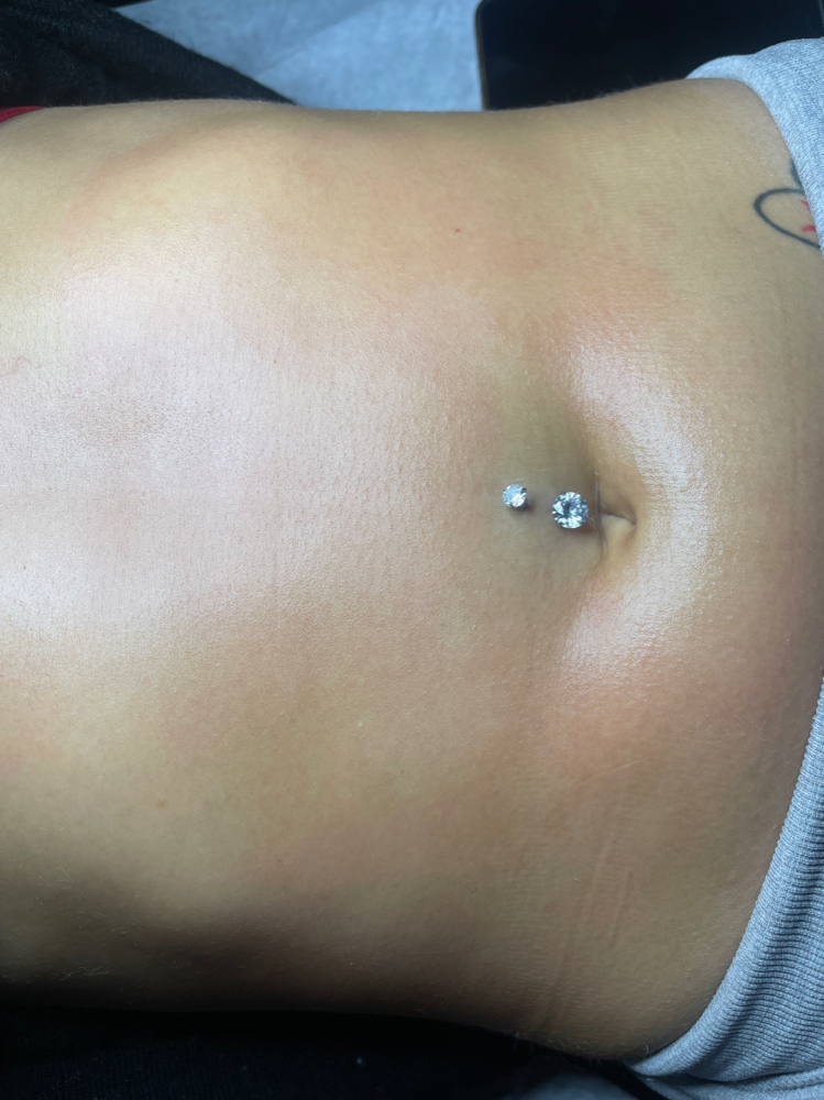Stomach