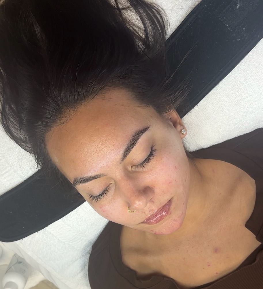 Enzyme & Dermaplane Facial