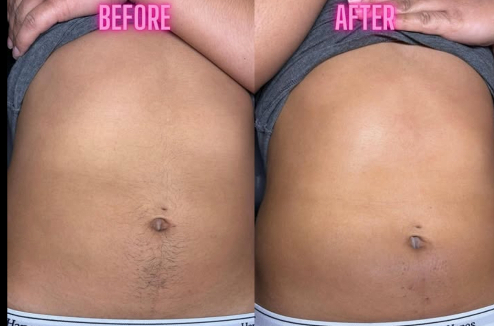 Stomach Wax