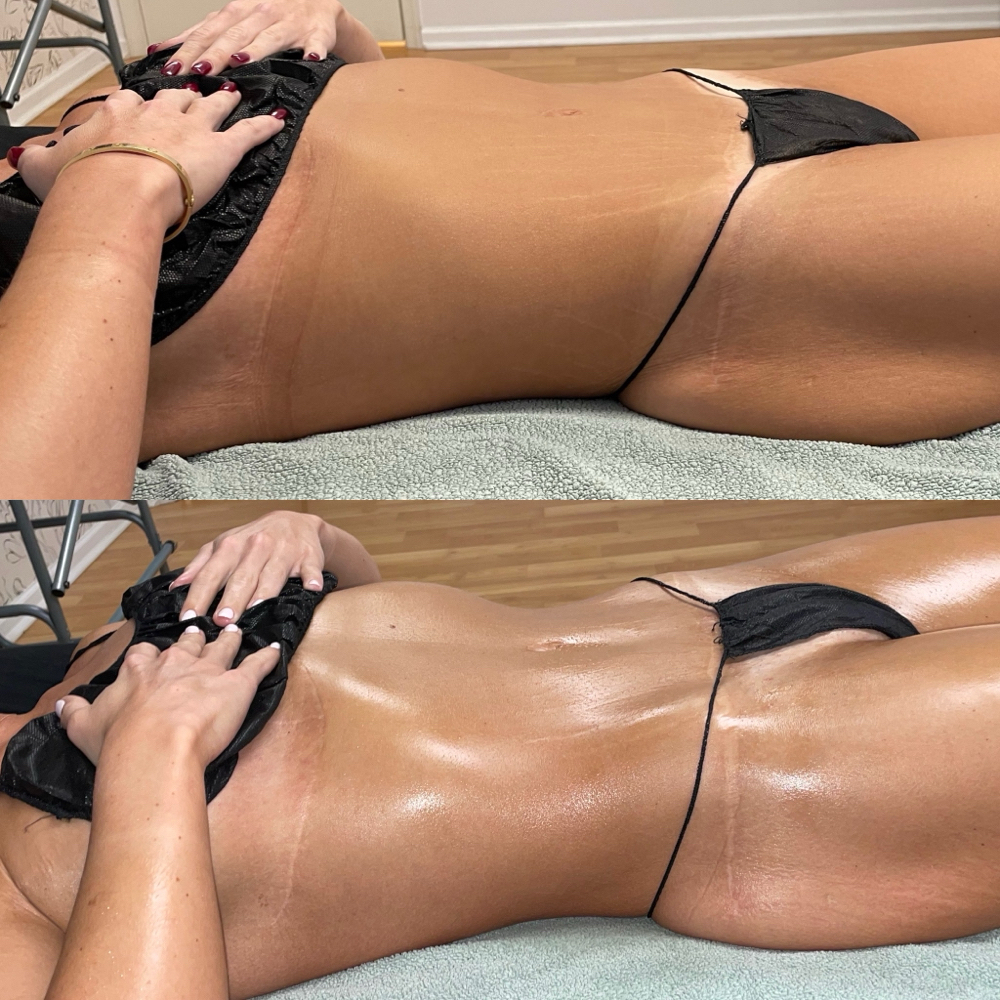 Full Body Lymphatic Drainage