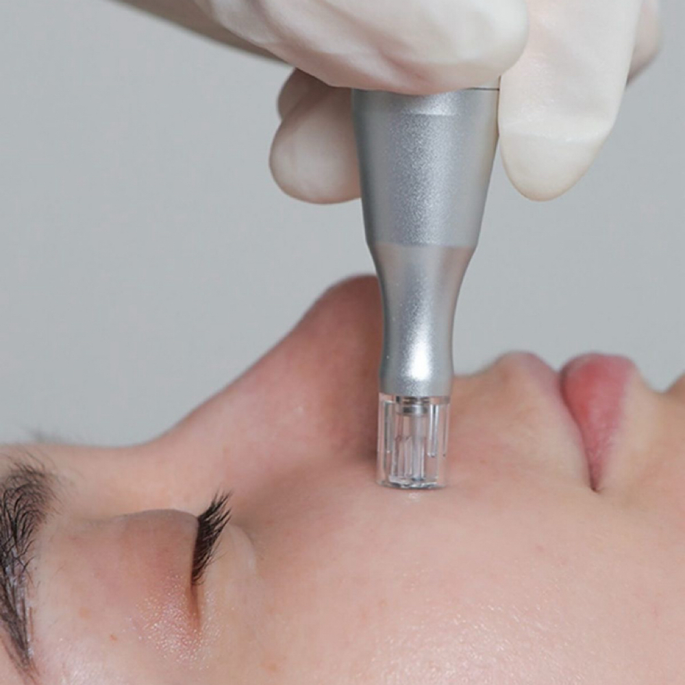 Microneedling at Sol Spa & Boutique in Archdale, NC