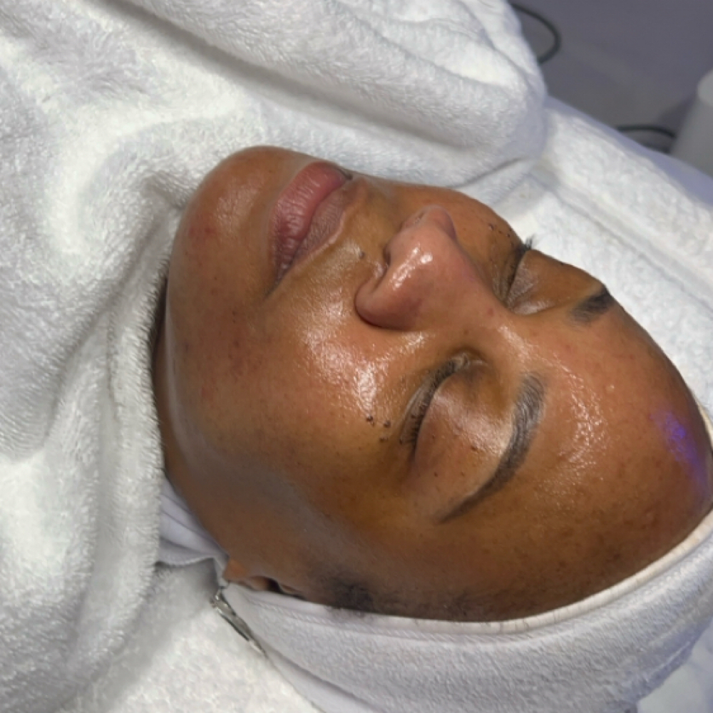 Mini HydraFacial (A Quickie) at Beauty Therapy by Chanel in Tucker, GA