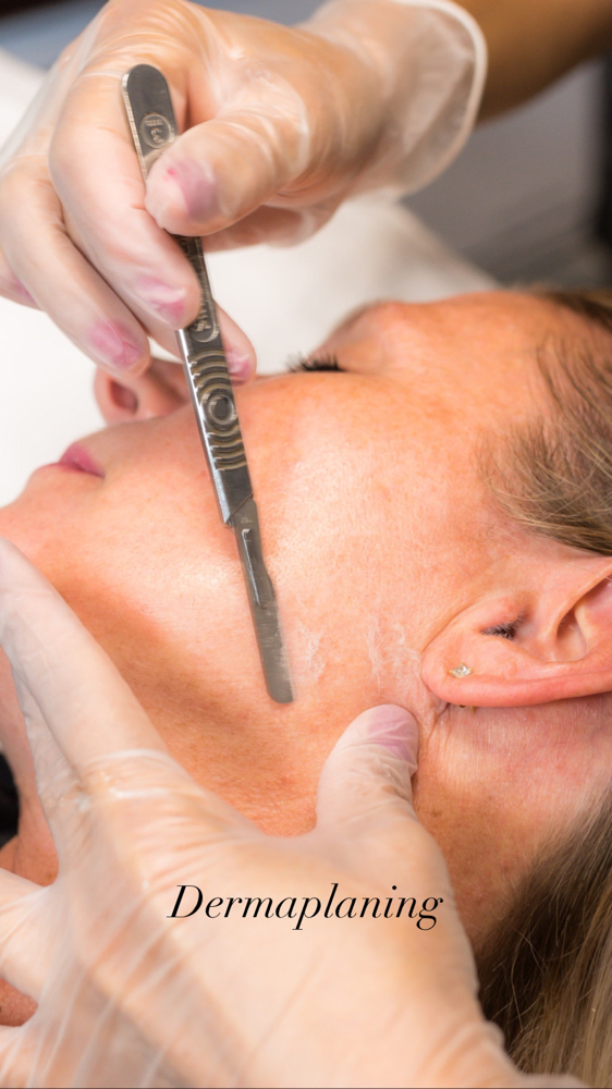 DERMAPLANING at Skin & Soul Skincare LLC in Tucson AZ, AZ