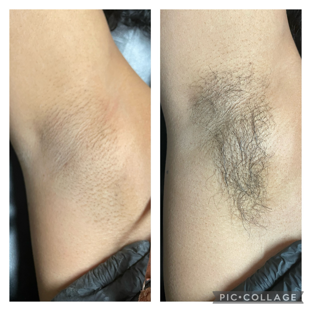 Underarm Wax